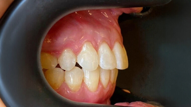 FOTOS WEB-18-ortodoncia D