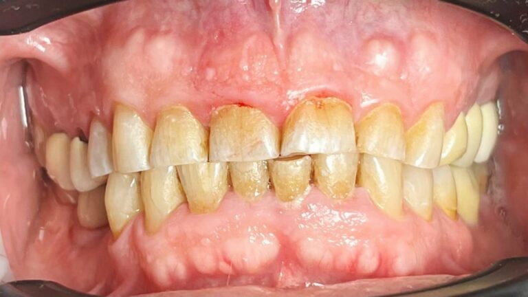 FOTOS WEB-3-estetica antes-min