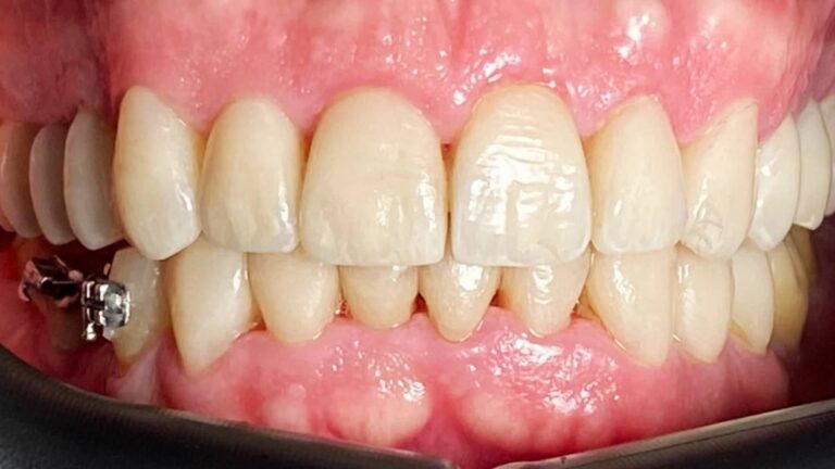 FOTOS WEB-4-estetica-despues-min