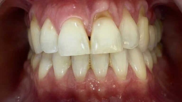 FOTOS WEB-7-peri-antes-min